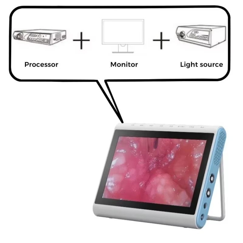 3‑In‑1 Medical Endoscopy Image - Medical Lab Images ulasan dan harga