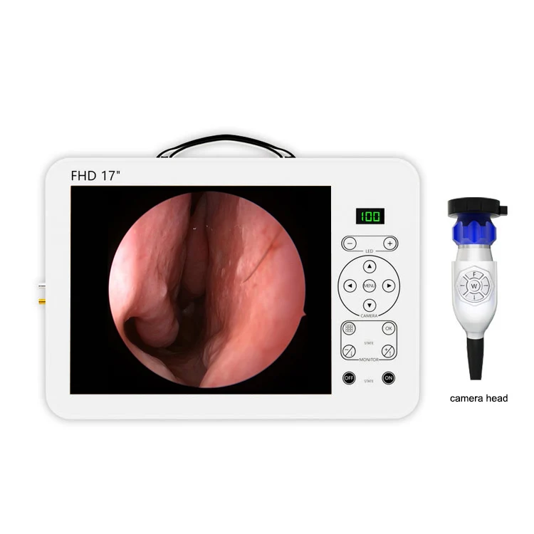 17 Inch HD Video Otoscope ENT  - Medical Lab Images ulasan dan harga